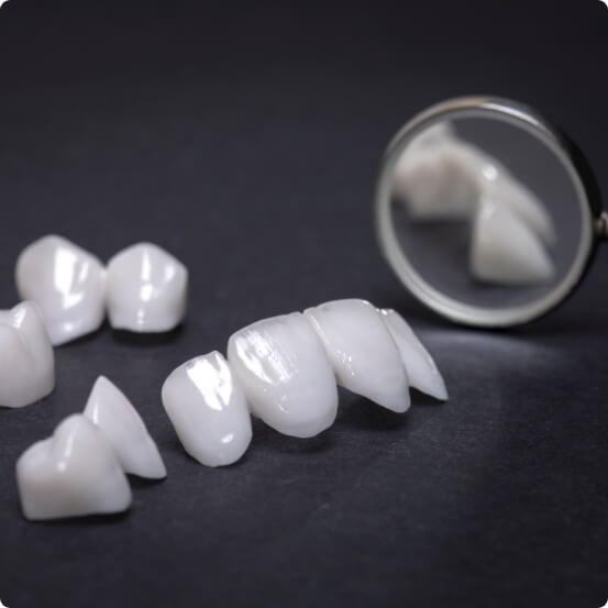 Metal free dental crowns prior to placement