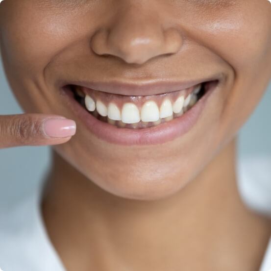 Closeup of smile after gum recontouring