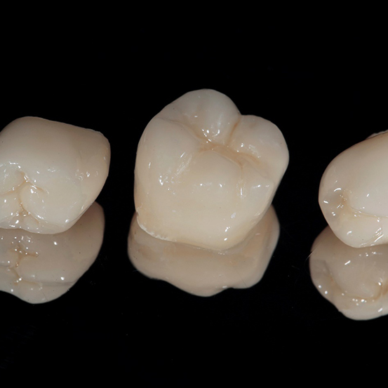 Dental crowns lying on a table