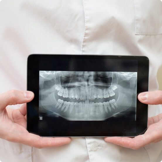 All digital x rays on tablet computer