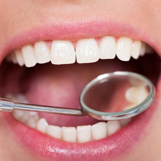 Mouth examined with dental mirror