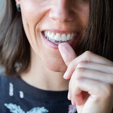 Closeup of woman putting on clear aligners