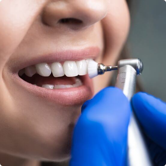 Dental patient receiving a fluoride treatment